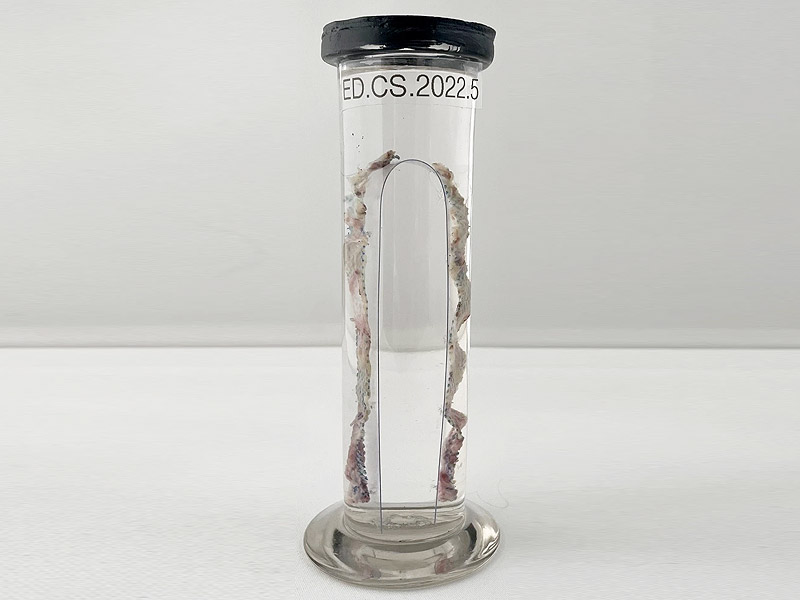 Pelvic mesh Pelvic mesh inside a tube